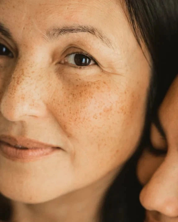 Close-up of a person’s face with natural freckles and a calm expression, with another person resting their face gently beside them.